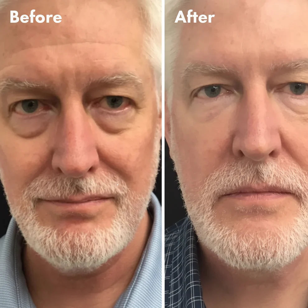 RAFCARE Smoothing Pull String Eye Cream – Advanced Anti-Aging & Brightening Formula